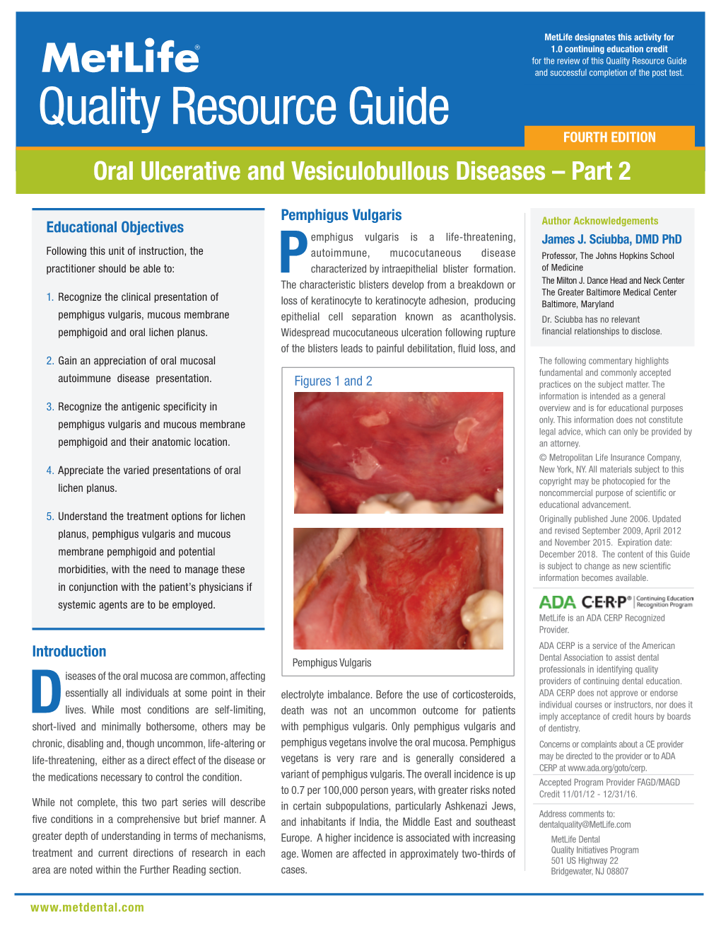 Oral Ulcerative and Vesiculobullous Diseases – Part 2