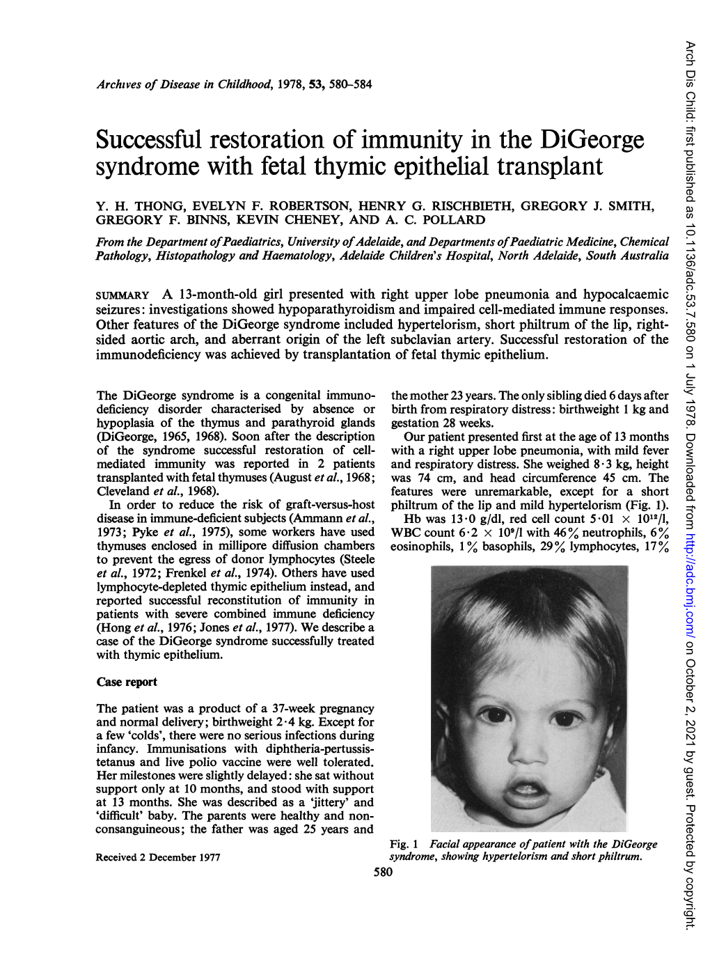 Successful Restoration of Immunity in the Digeorge Syndrome with Fetal Thymic Epithelial Transplant