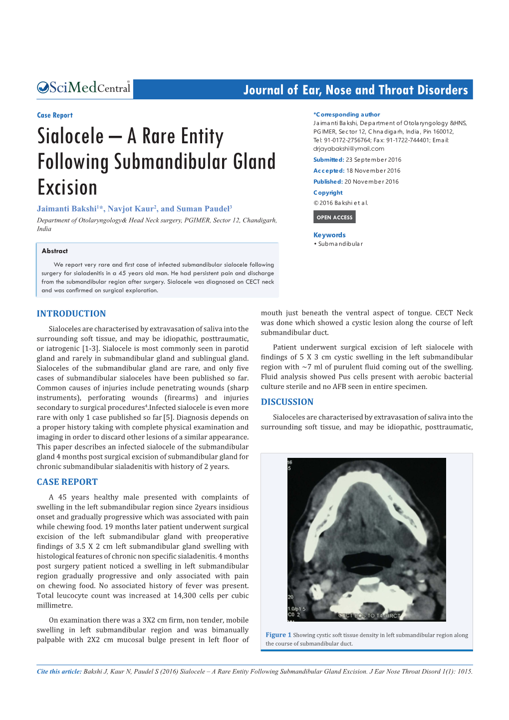Sialocele – a Rare Entity Following Submandibular Gland Excision