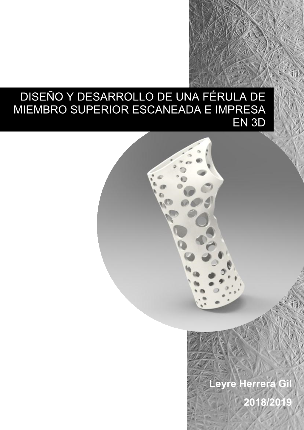 Diseño Y Desarrollo De Una Férula De Miembro Superior Escaneada E Impresa En 3D