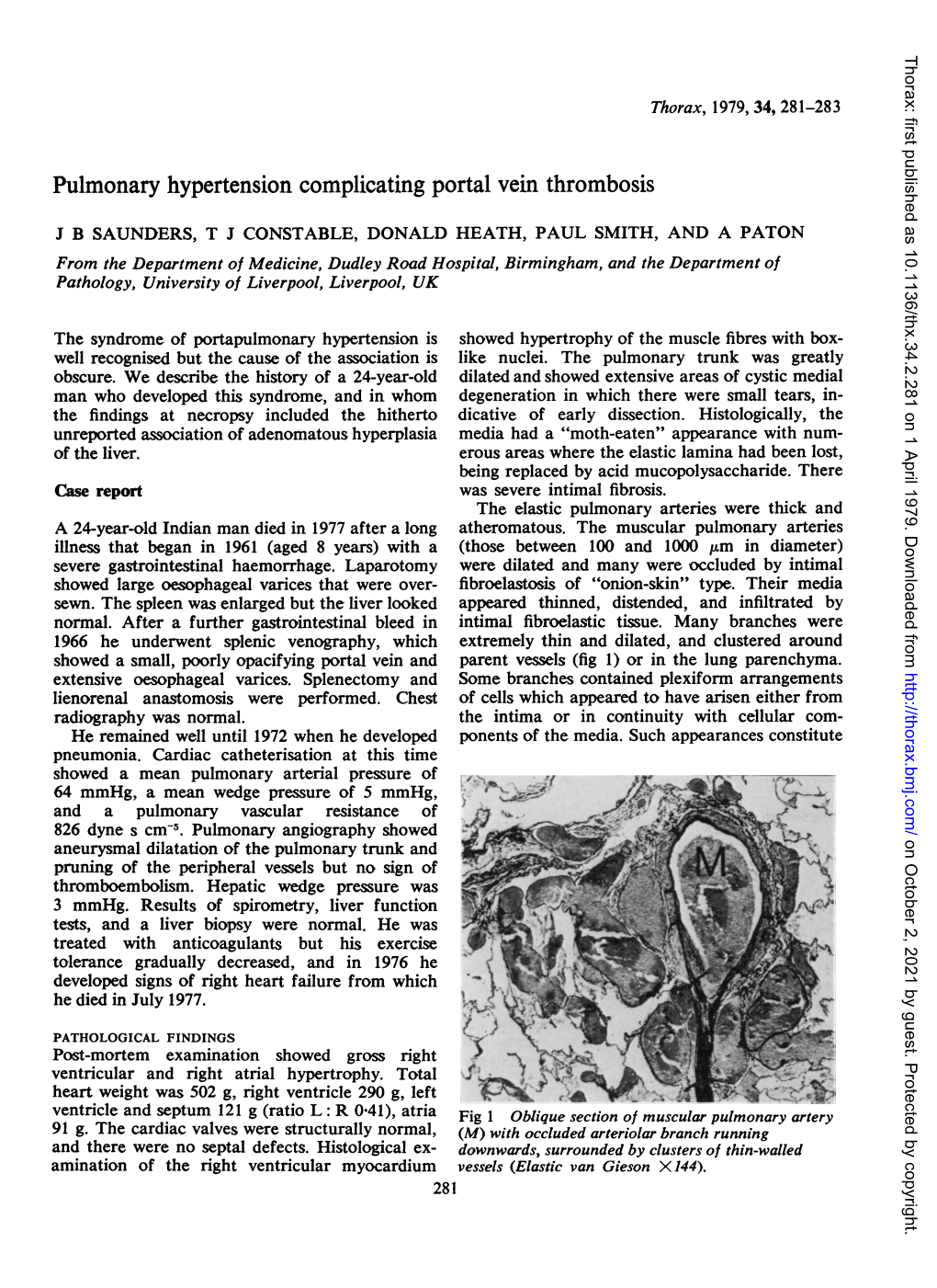 Pulmonary Hypertension Complicating Portal Vein Thrombosis