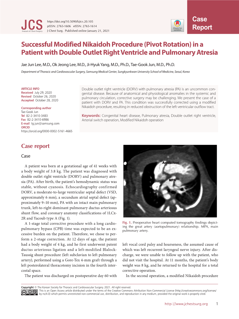 Successful Modified Nikaidoh Procedure (Pivot Rotation) in a Patient with Double Outlet Right Ventricle and Pulmonary Atresia