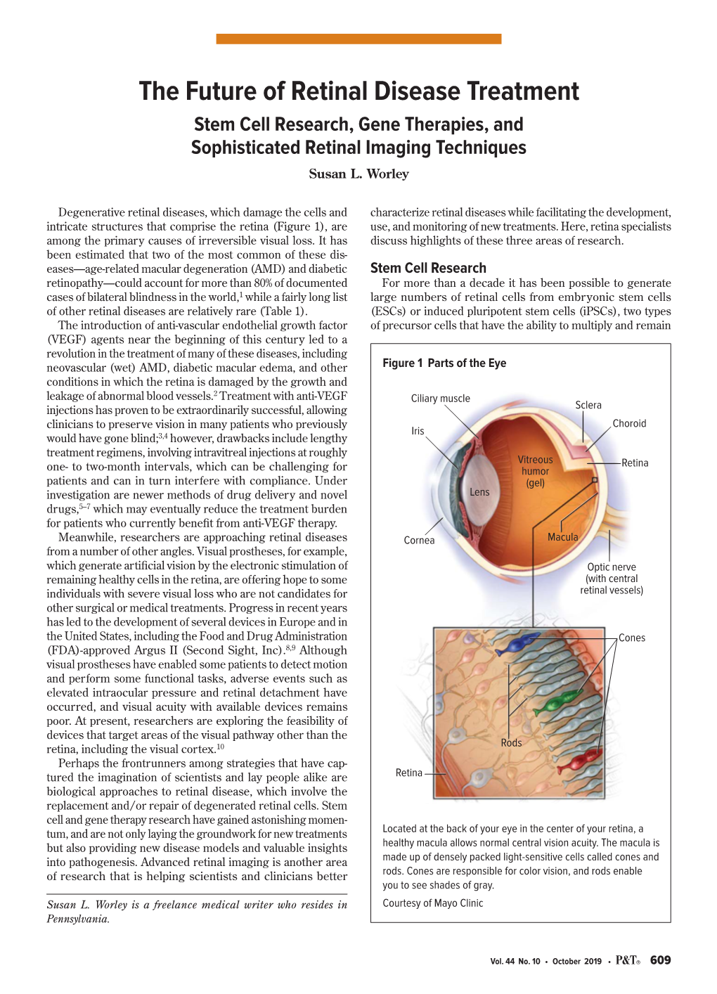 The Future of Retinal Disease Treatment Stem Cell Research, Gene Therapies, and Sophisticated Retinal Imaging Techniques Susan L