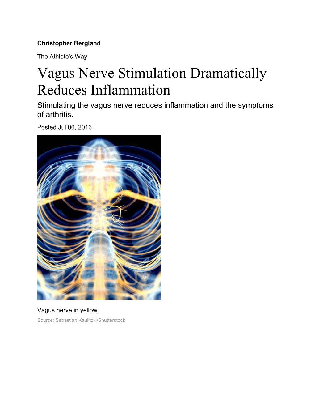 Vagus Nerve Stimulation Dramatically Reduces Inflammation Stimulating the Vagus Nerve Reduces Inflammation and the Symptoms of Arthritis