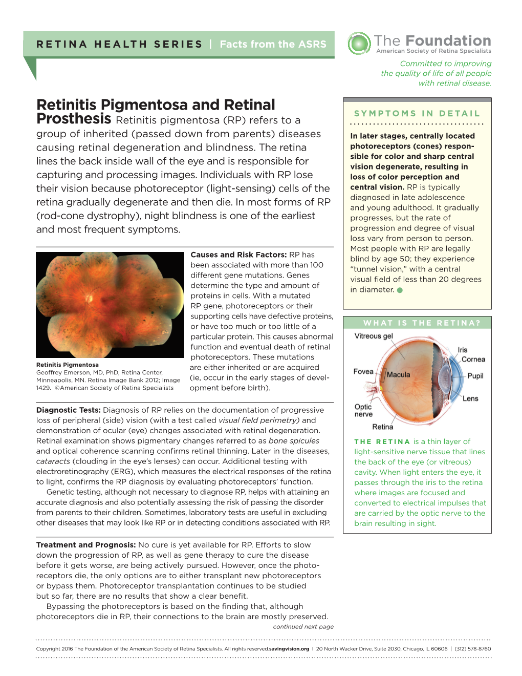 Retinitis Pigmentosa and Retinal Prosthesis Continued from Previous Page