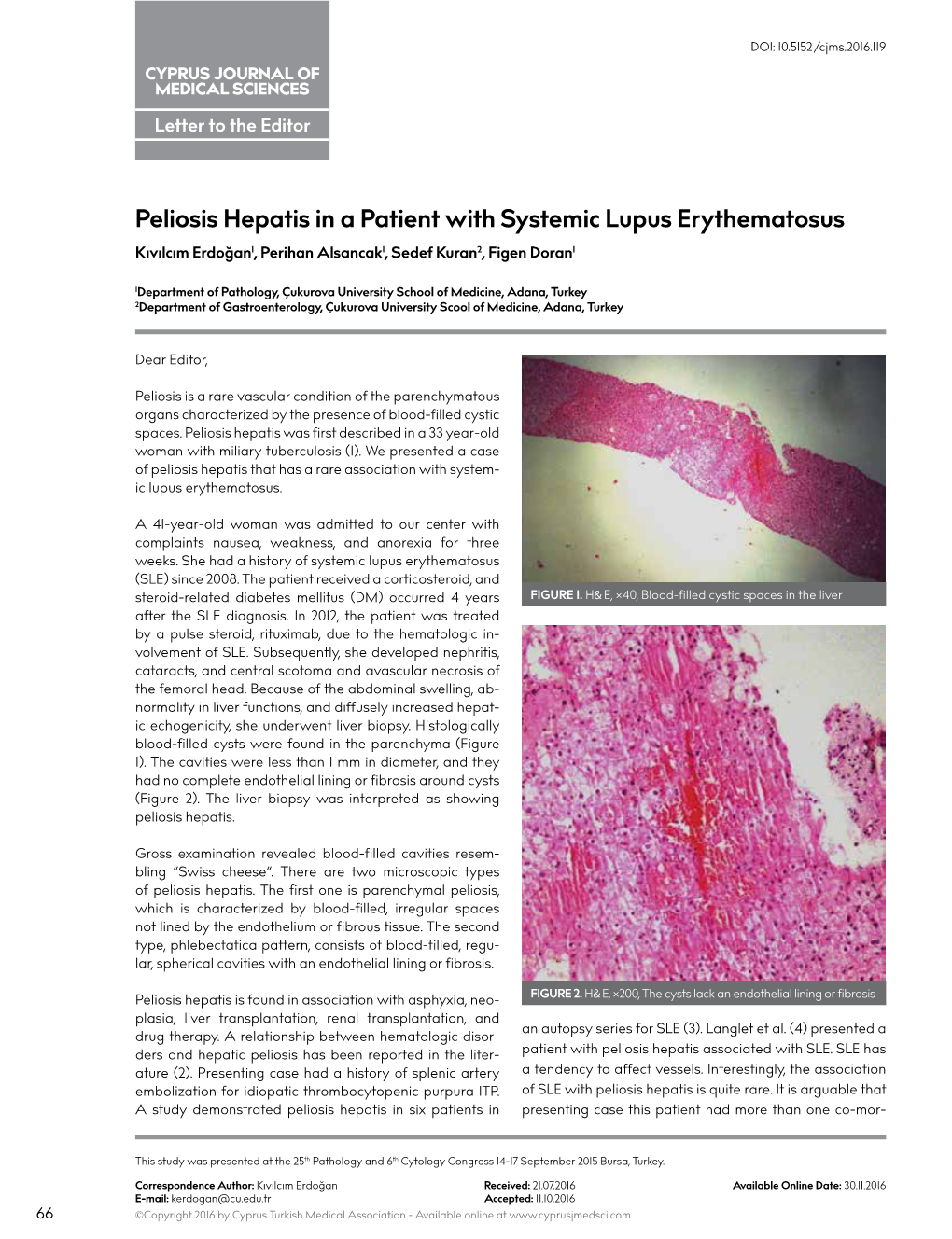 Peliosis Hepatis in a Patient with Systemic Lupus Erythematosus Kıvılcım Erdoğan1, Perihan Alsancak1, Sedef Kuran2, Figen Doran1