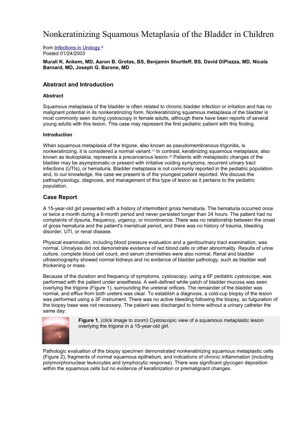 Nonkeratinizing Squamous Metaplasia of the Bladder in Children