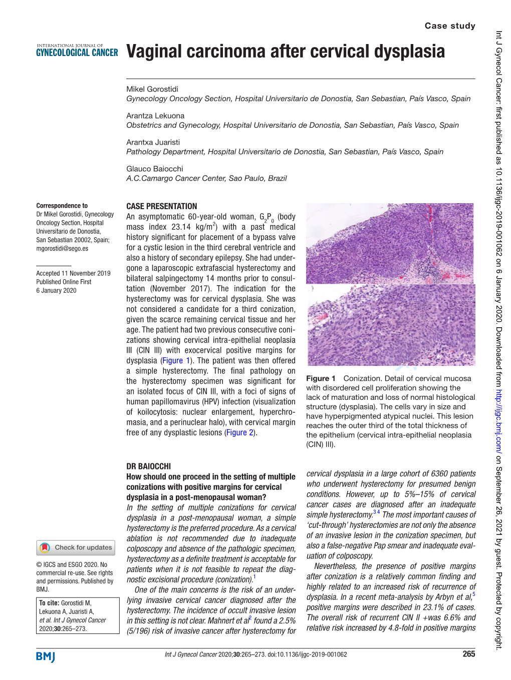 Vaginal Carcinoma After Cervical Dysplasia