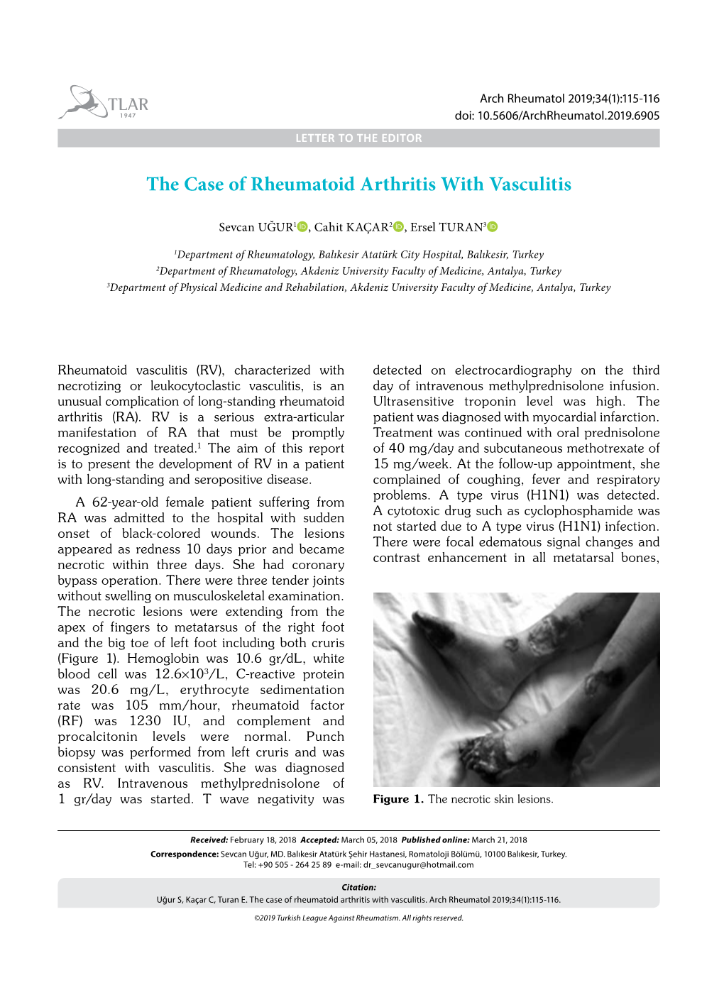 The Case of Rheumatoid Arthritis with Vasculitis