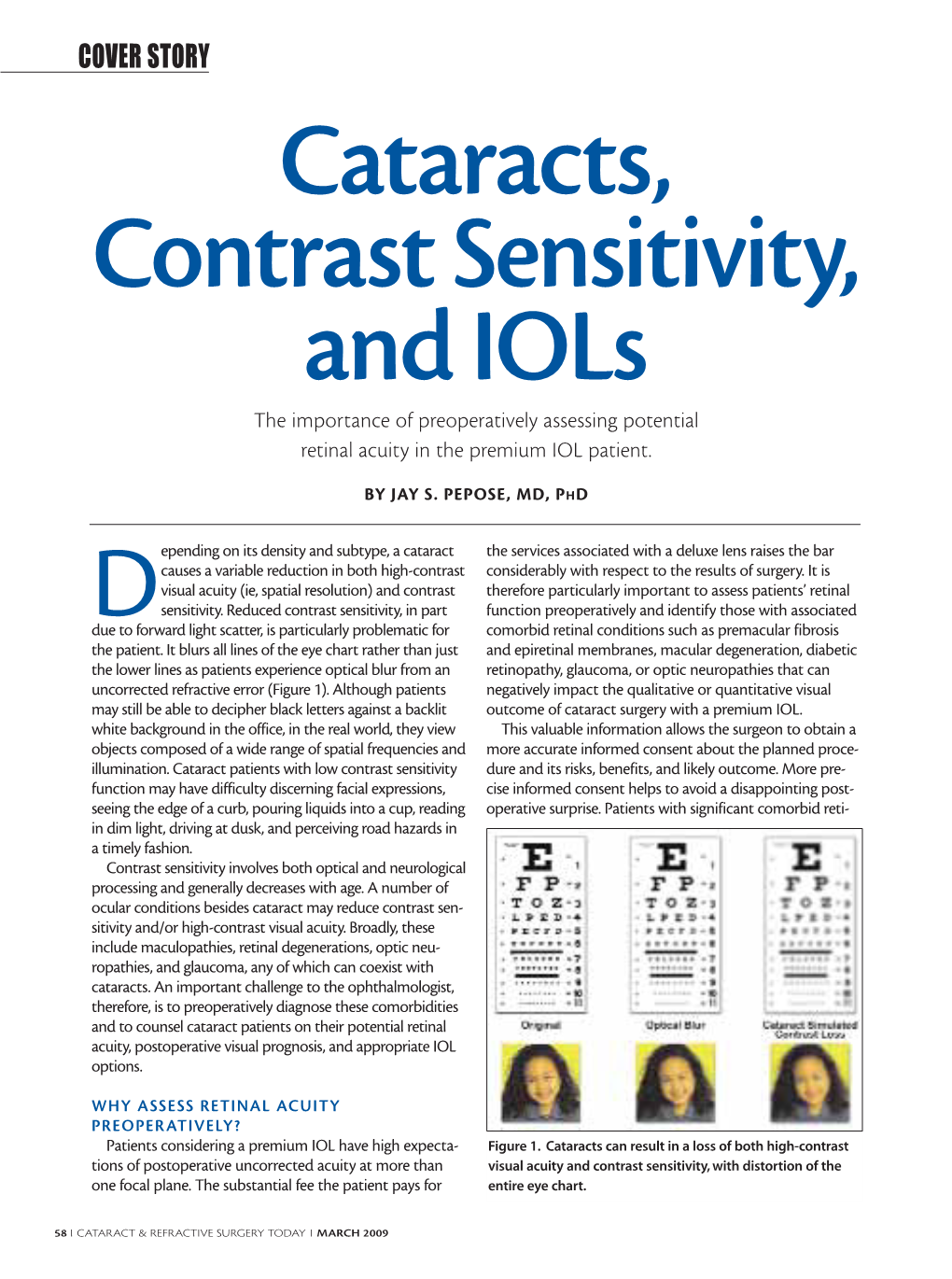 Cataracts, Contrast Sensitivity, and Iols the Importance of Preoperatively Assessing Potential Retinal Acuity in the Premium IOL Patient