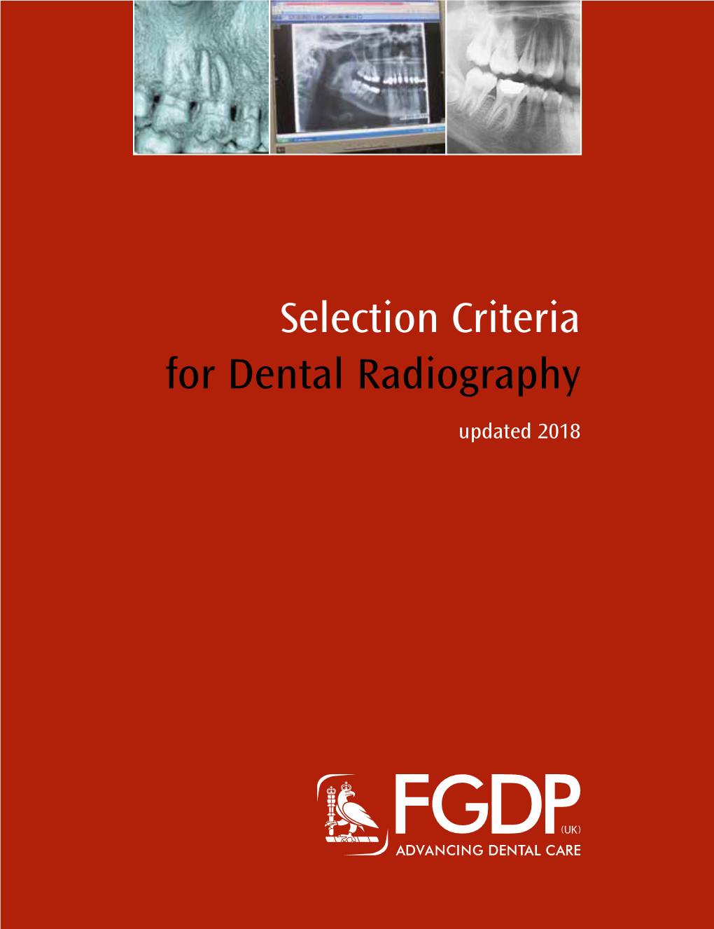 Selection Criteria for Dental Radiography