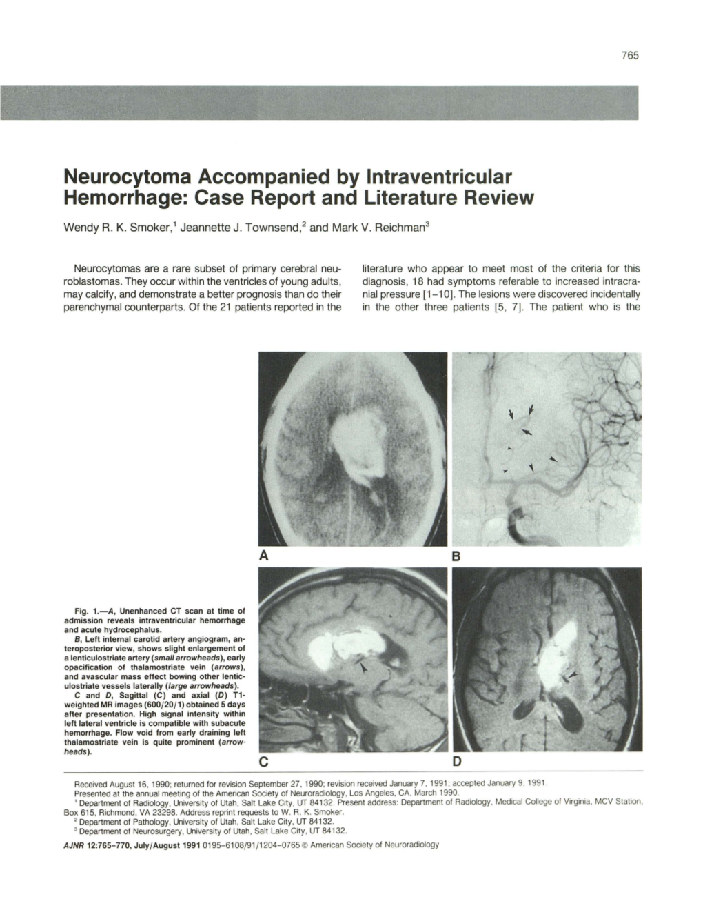 Neurocytoma Accompanied by Intraventricular Hemorrhage: Case Report and Literature Review