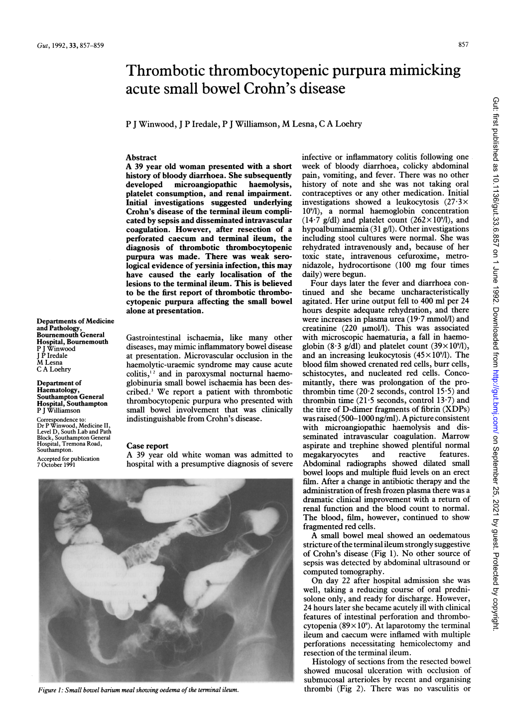Thrombotic Thrombocytopenic Purpura Mimicking Acute Small Bowel Crohn's Disease Gut: First Published As 10.1136/Gut.33.6.857 on 1 June 1992