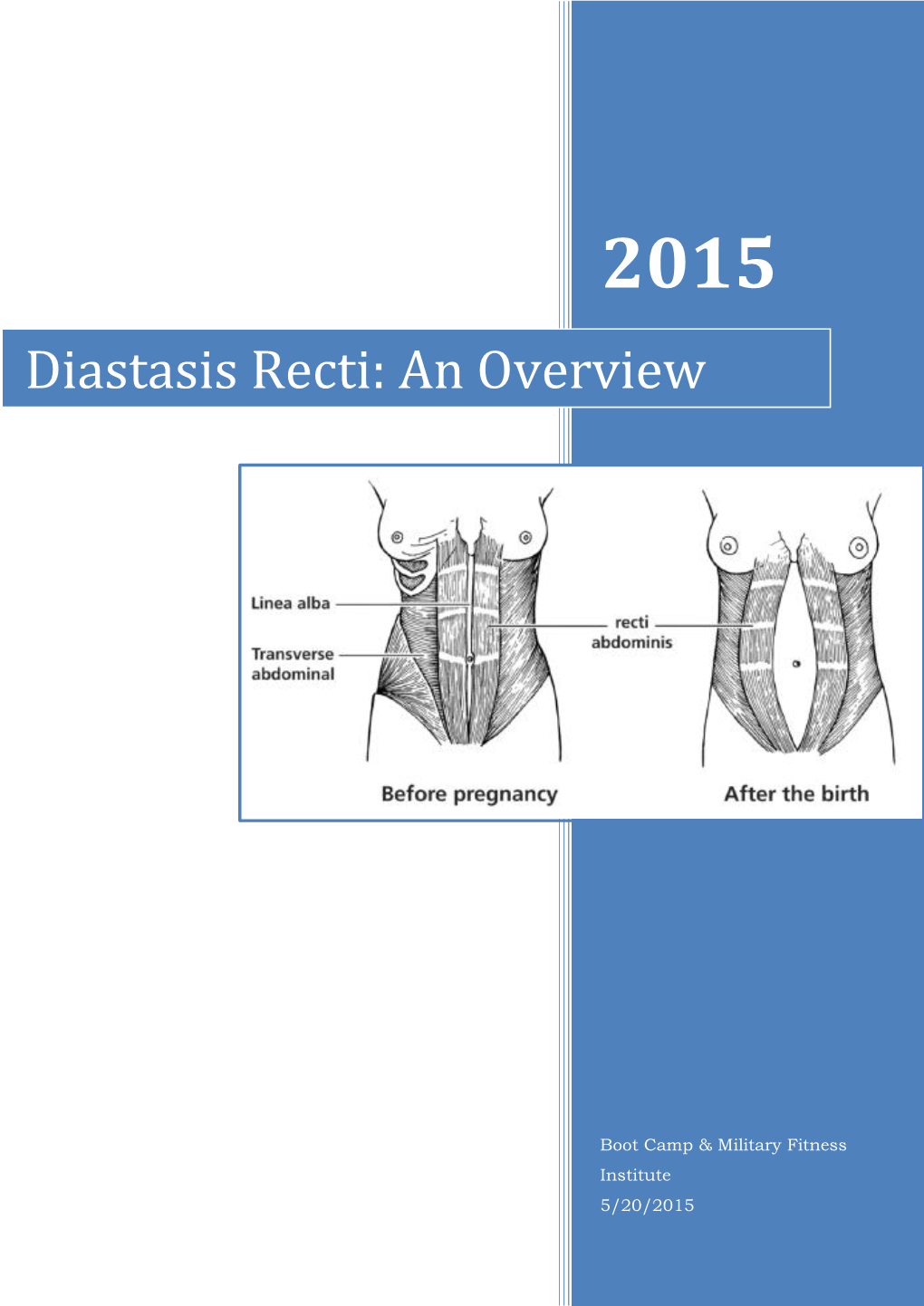 Diastasis Recti: an Overview