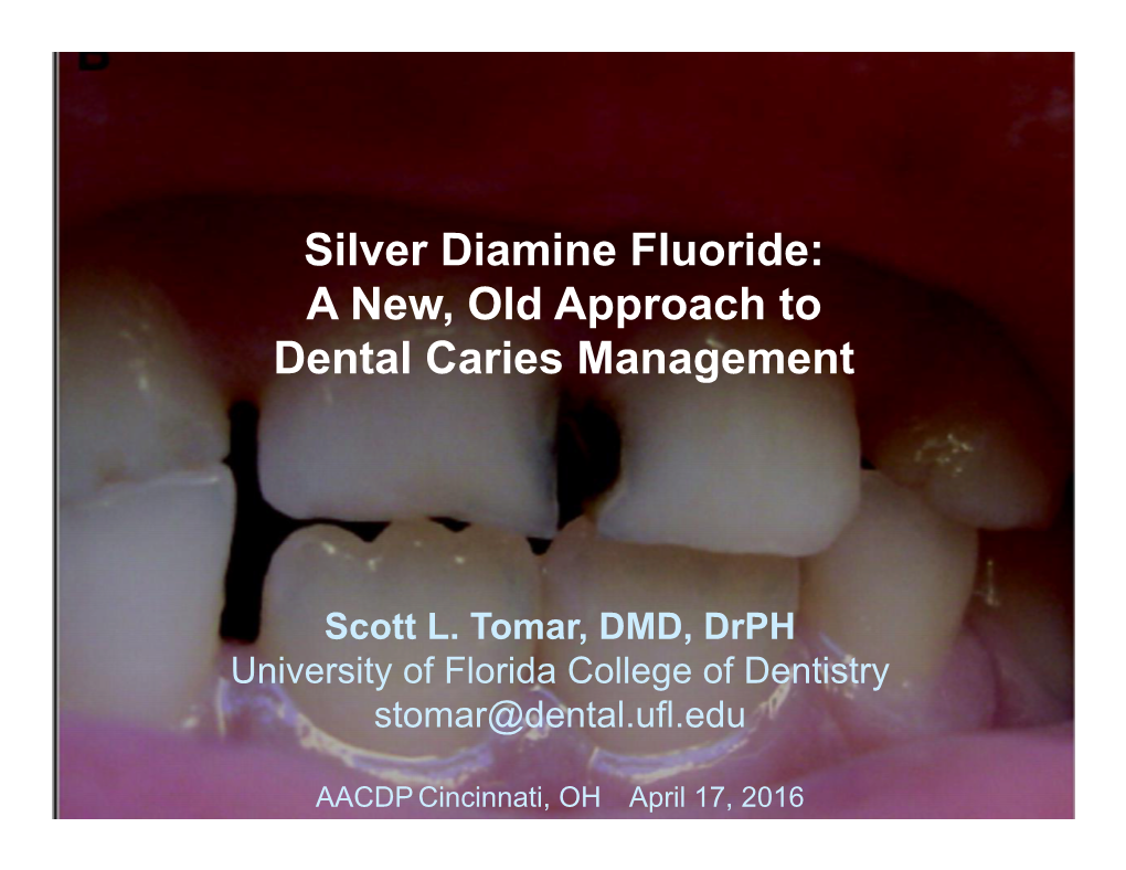 Silver Diamine Fluoride: a New, Old Approach to Dental Caries Management