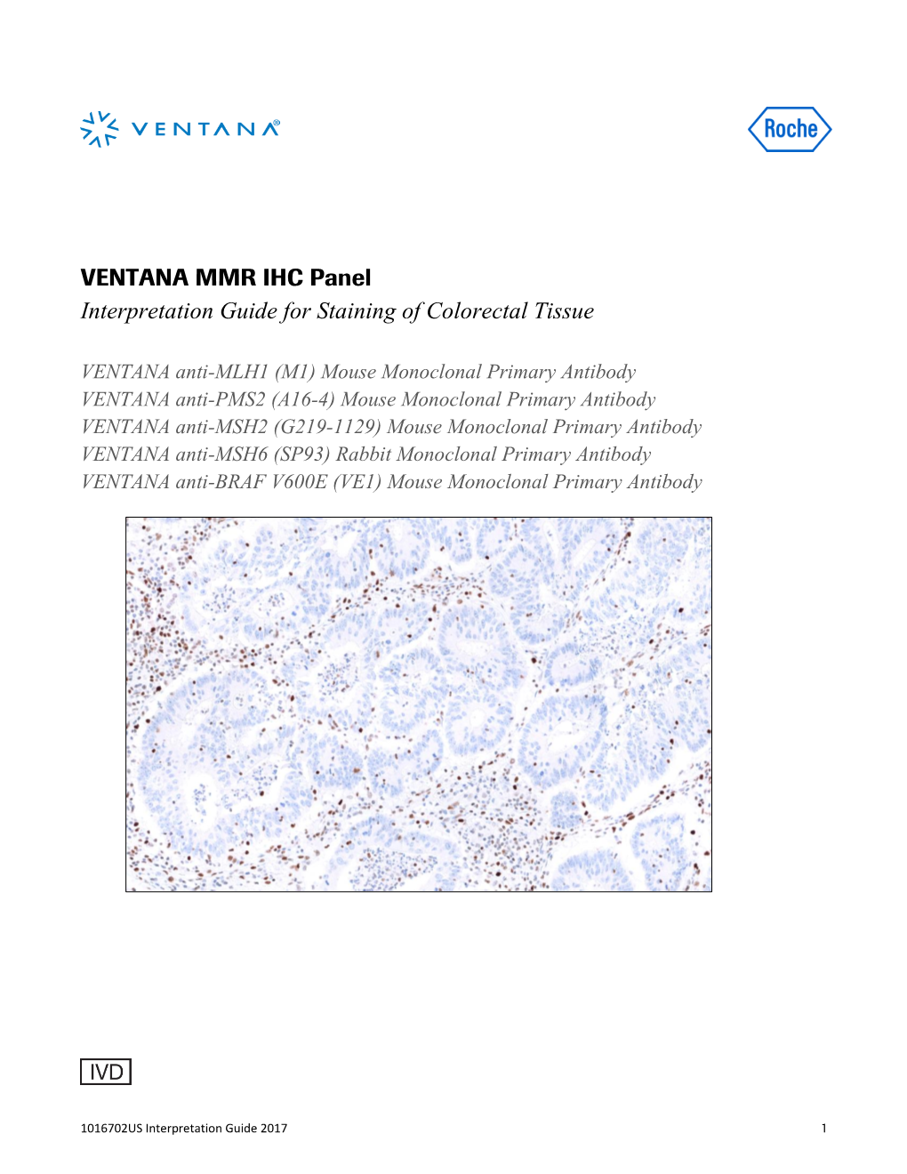 VENTANA MMR IHC Panel Interpretation Guide for Staining of Colorectal Tissue