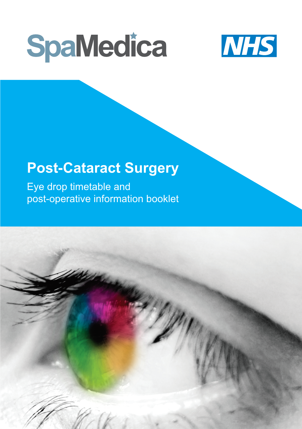 Post-Cataract Surgery