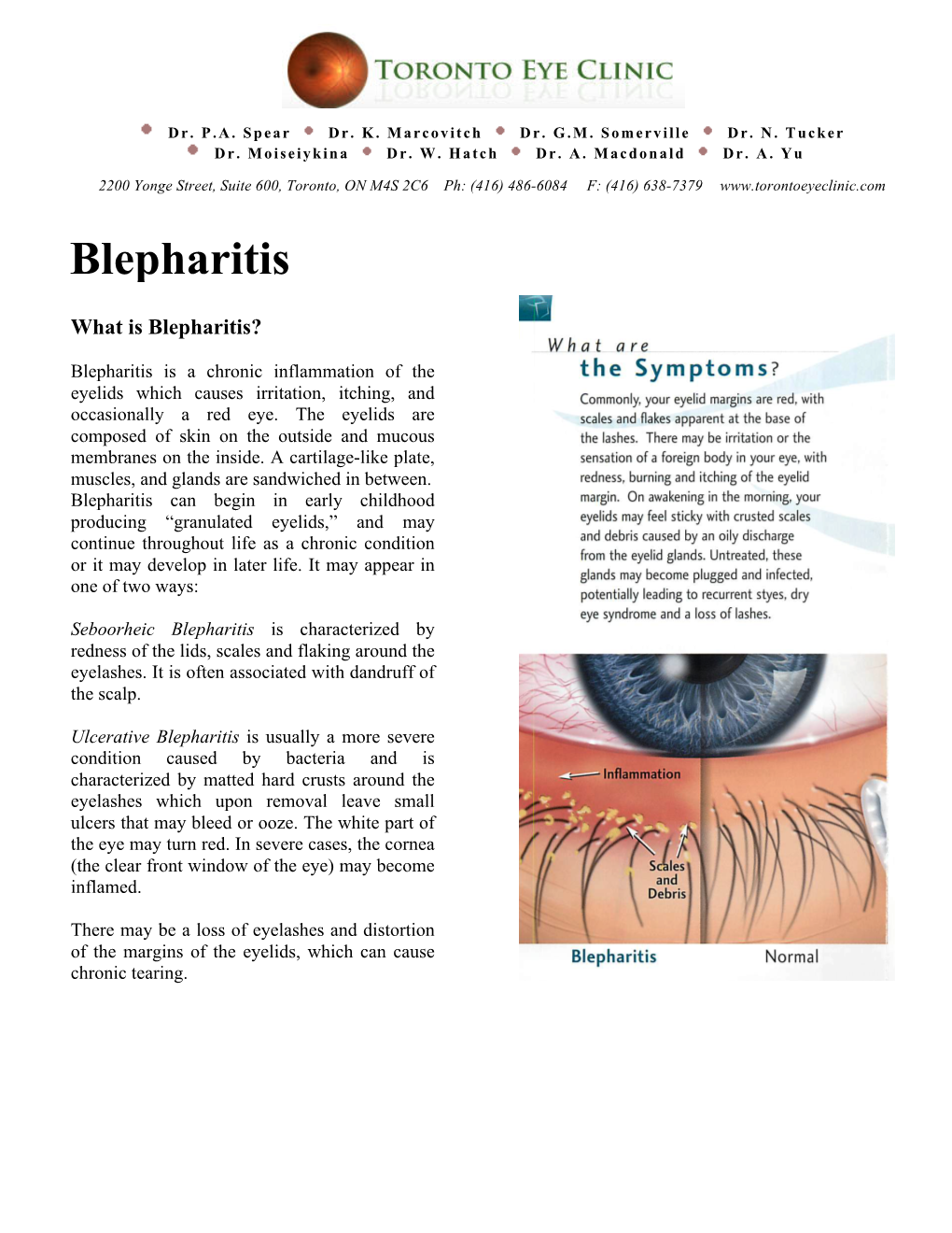 Blepharitis Handout