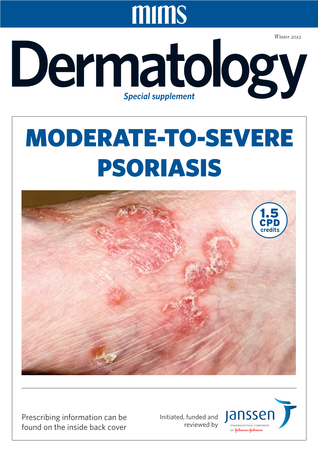 Moderate-To-Severe Psoriasis