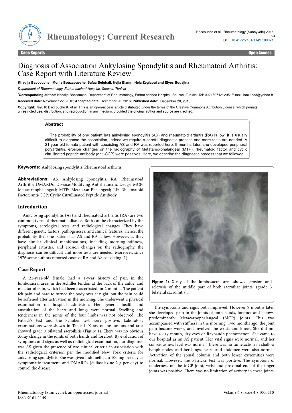 Diagnosis of Association Ankylosing Spondylitis and Rheumatoid Arthritis