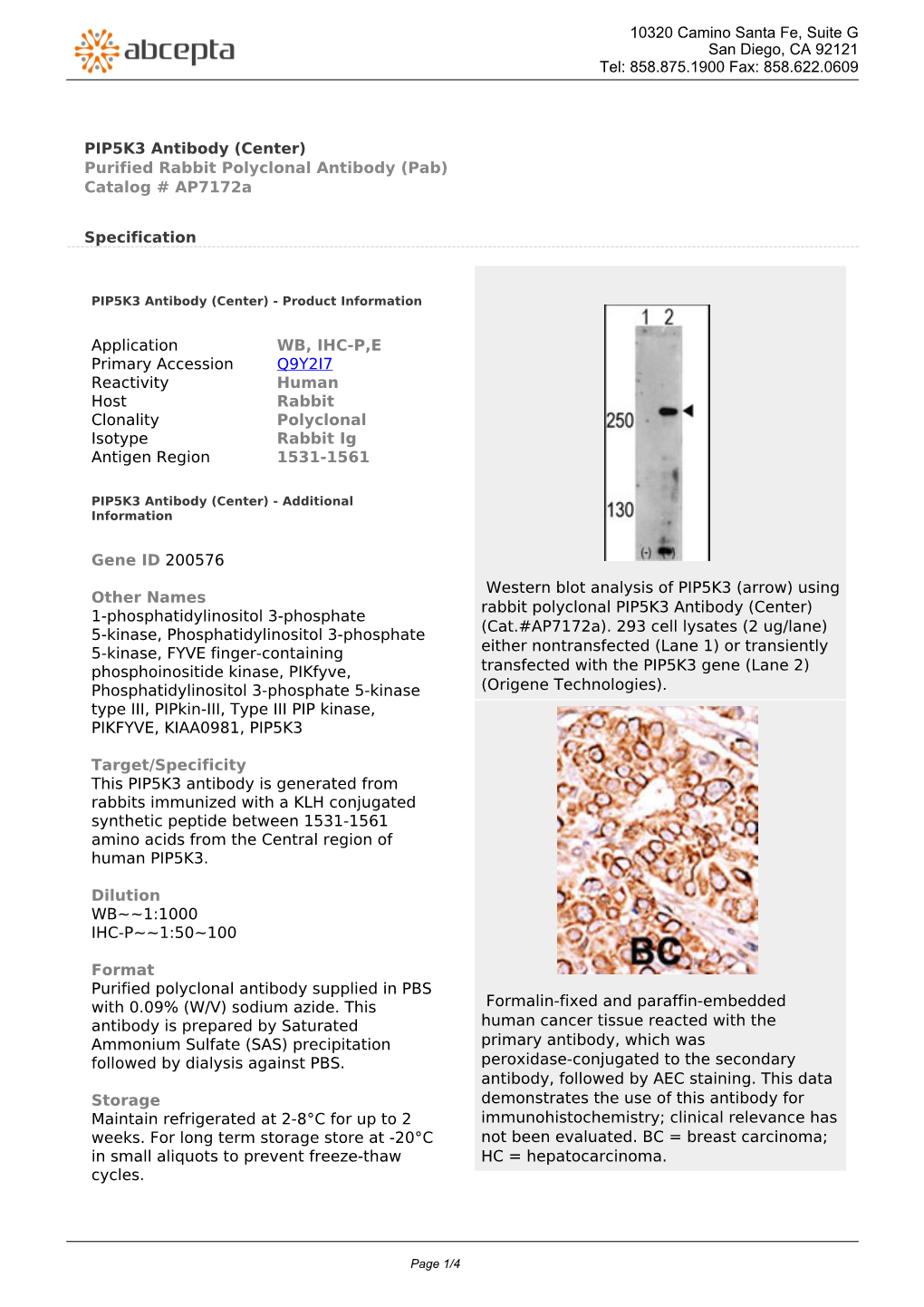 PIP5K3 Antibody (Center) Purified Rabbit Polyclonal Antibody (Pab) Catalog # Ap7172a