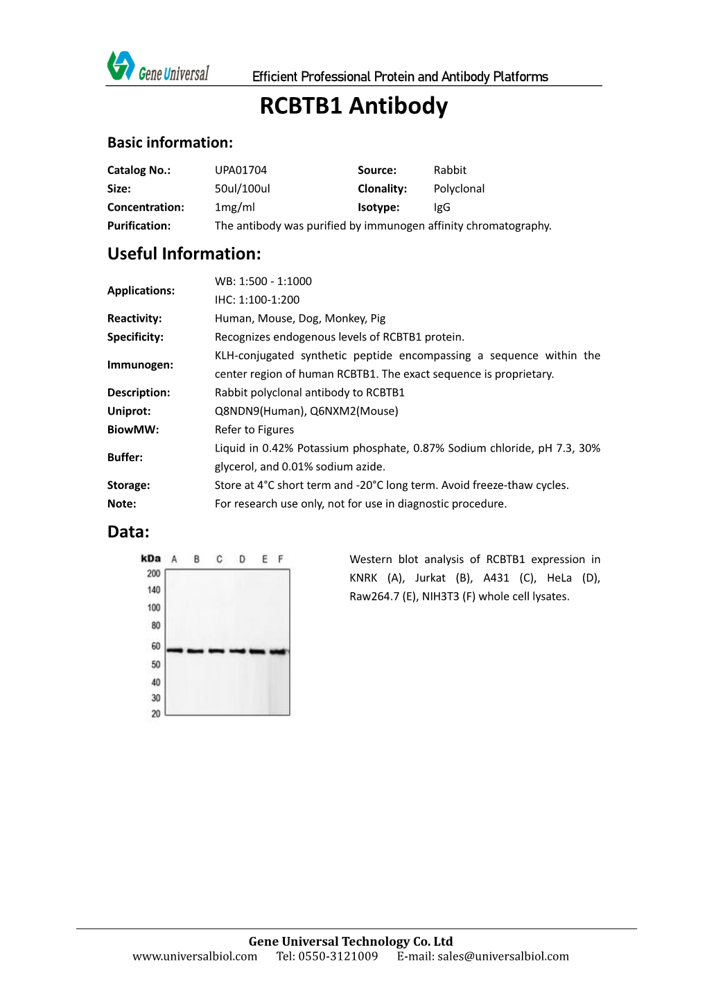 RCBTB1 Antibody