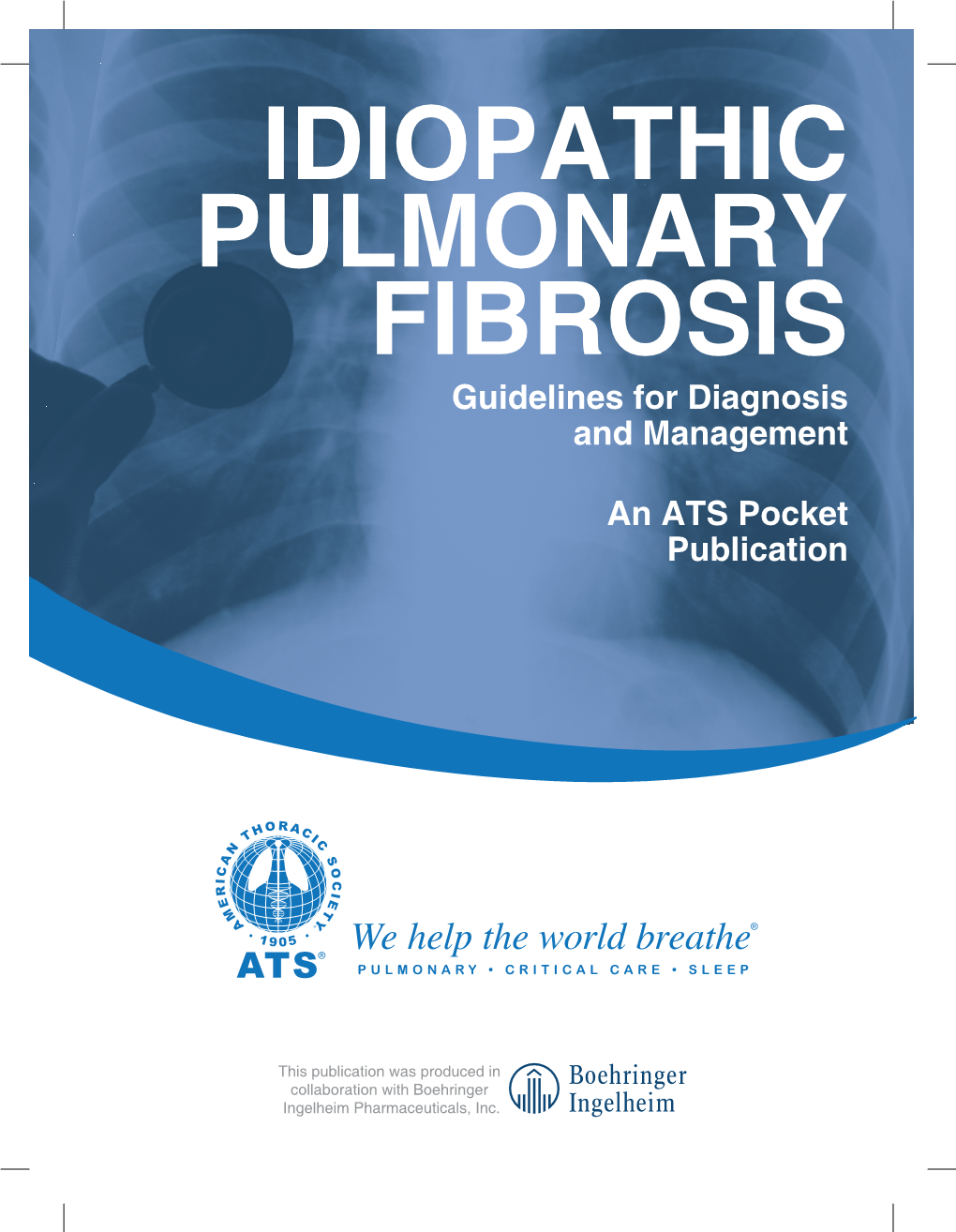 IDIOPATHIC PULMONARY FIBROSIS Guidelines for Diagnosis and Management