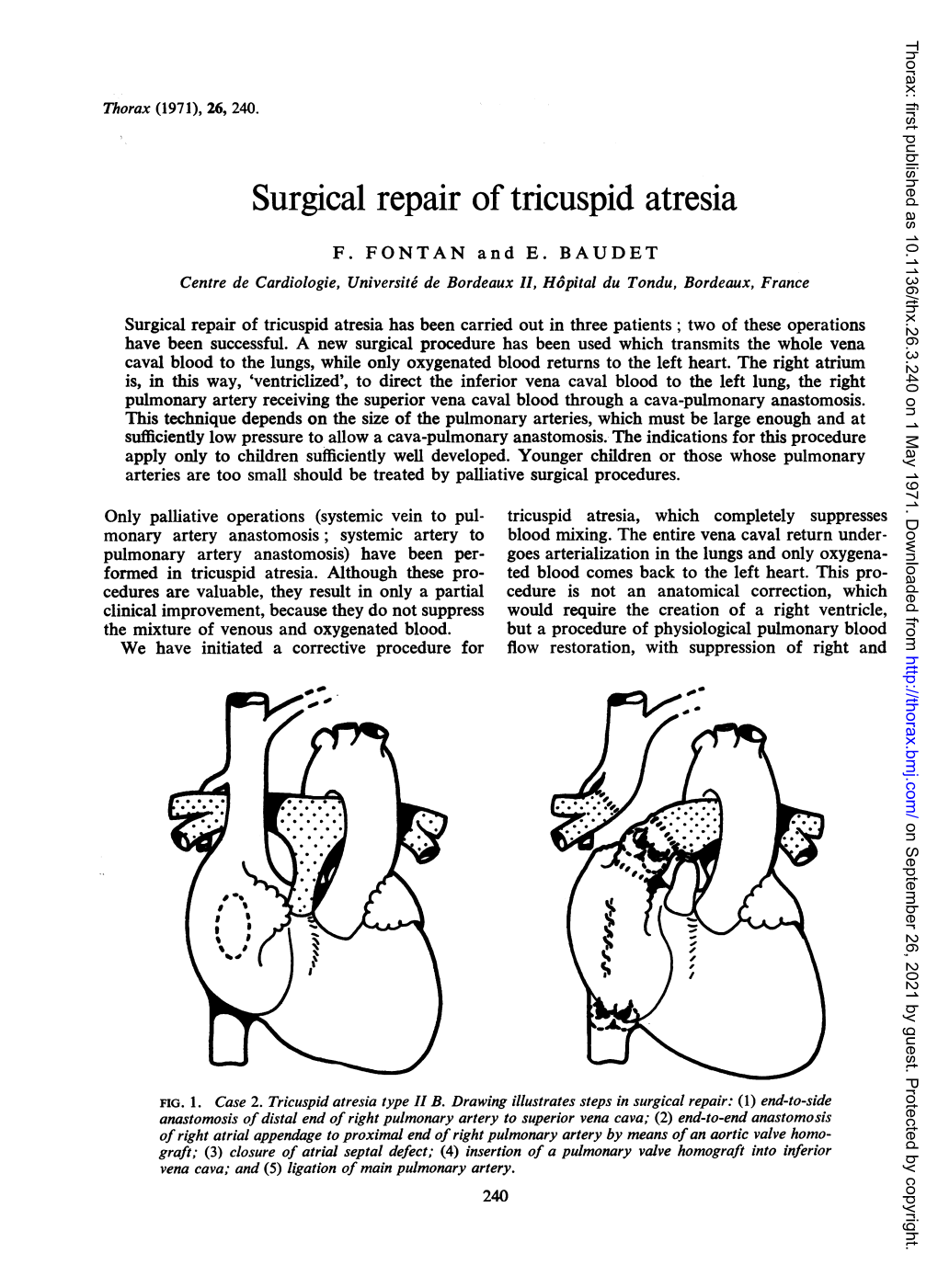 Surgical Repair of Tricuspid Atresia