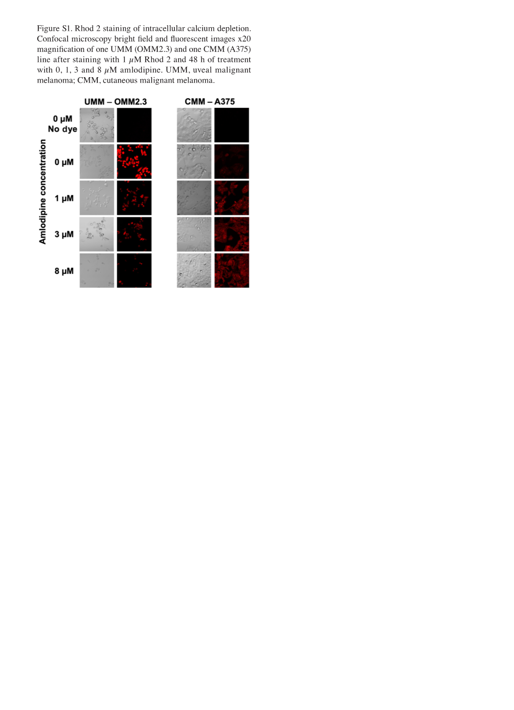 Figure S1. Rhod 2 Staining of Intracellular Calcium Depletion