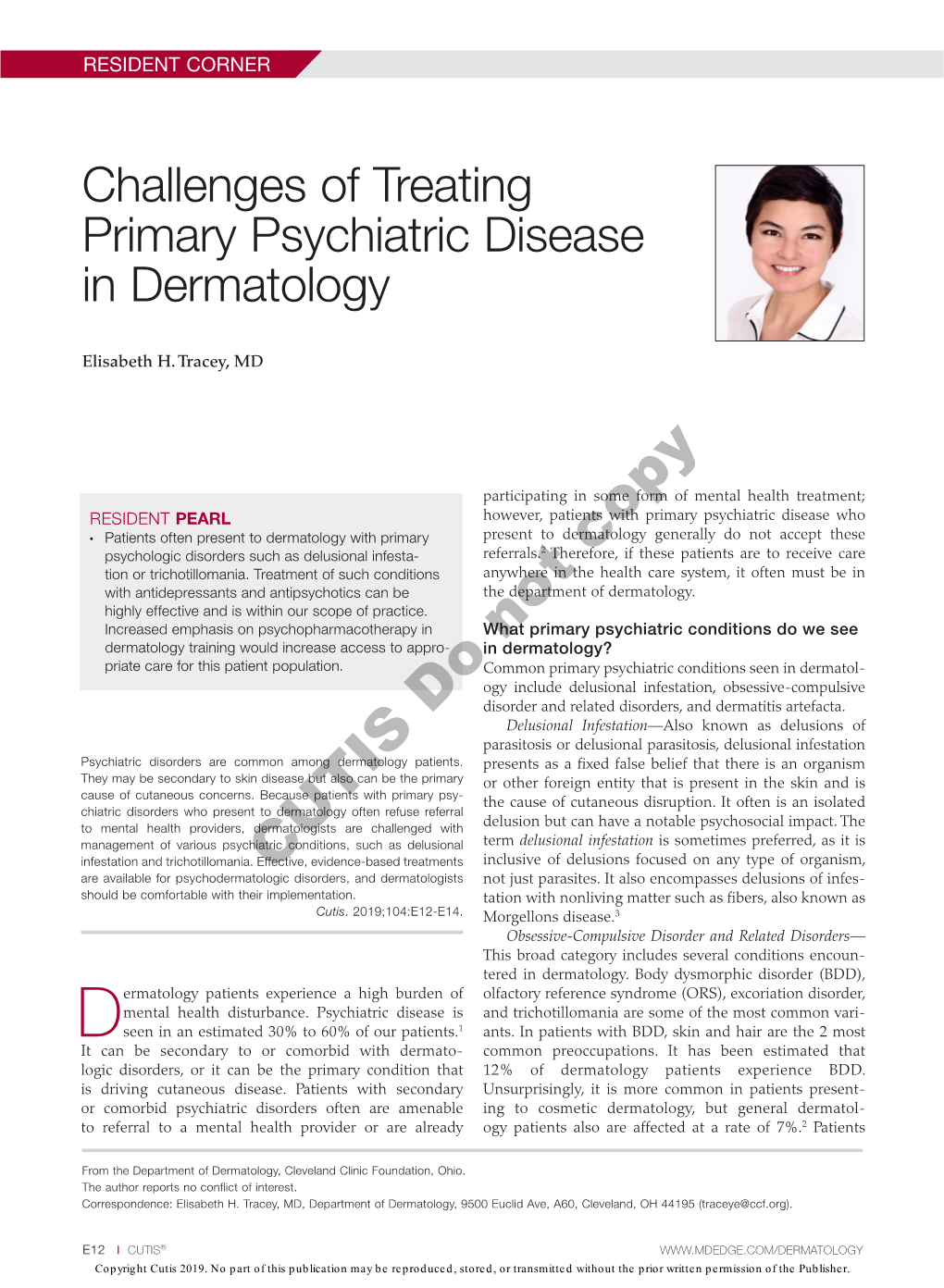 Challenges of Treating Primary Psychiatric Disease in Dermatology