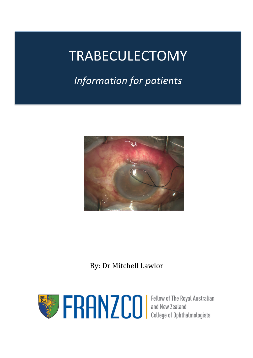 Trabeculectomy