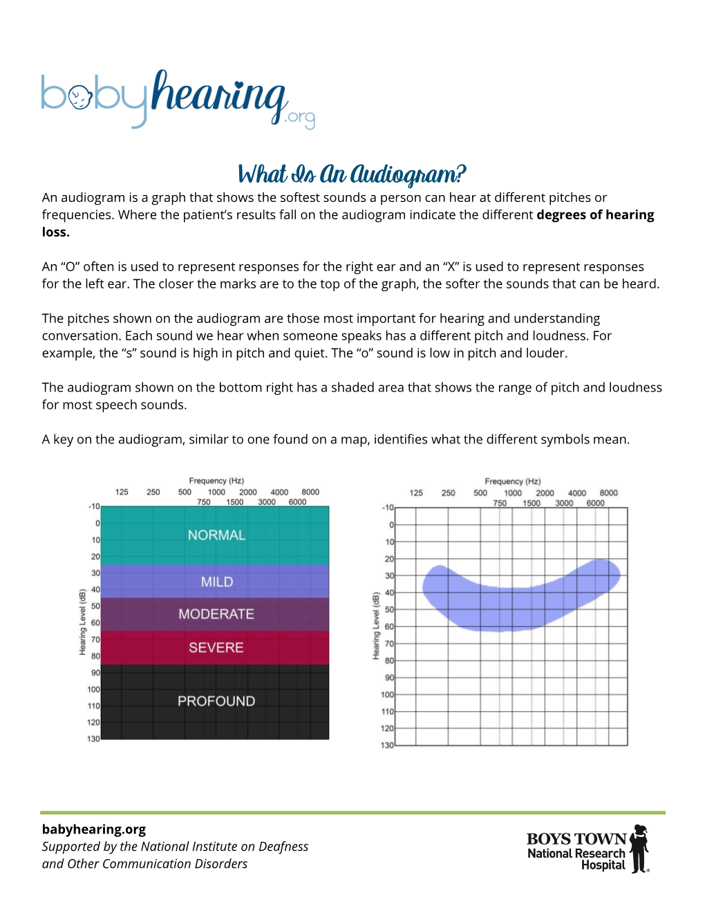 What Is an Audiogram? an Audiogram Is a Graph That Shows the Softest Sounds a Person Can Hear at Different Pitches Or Frequencies