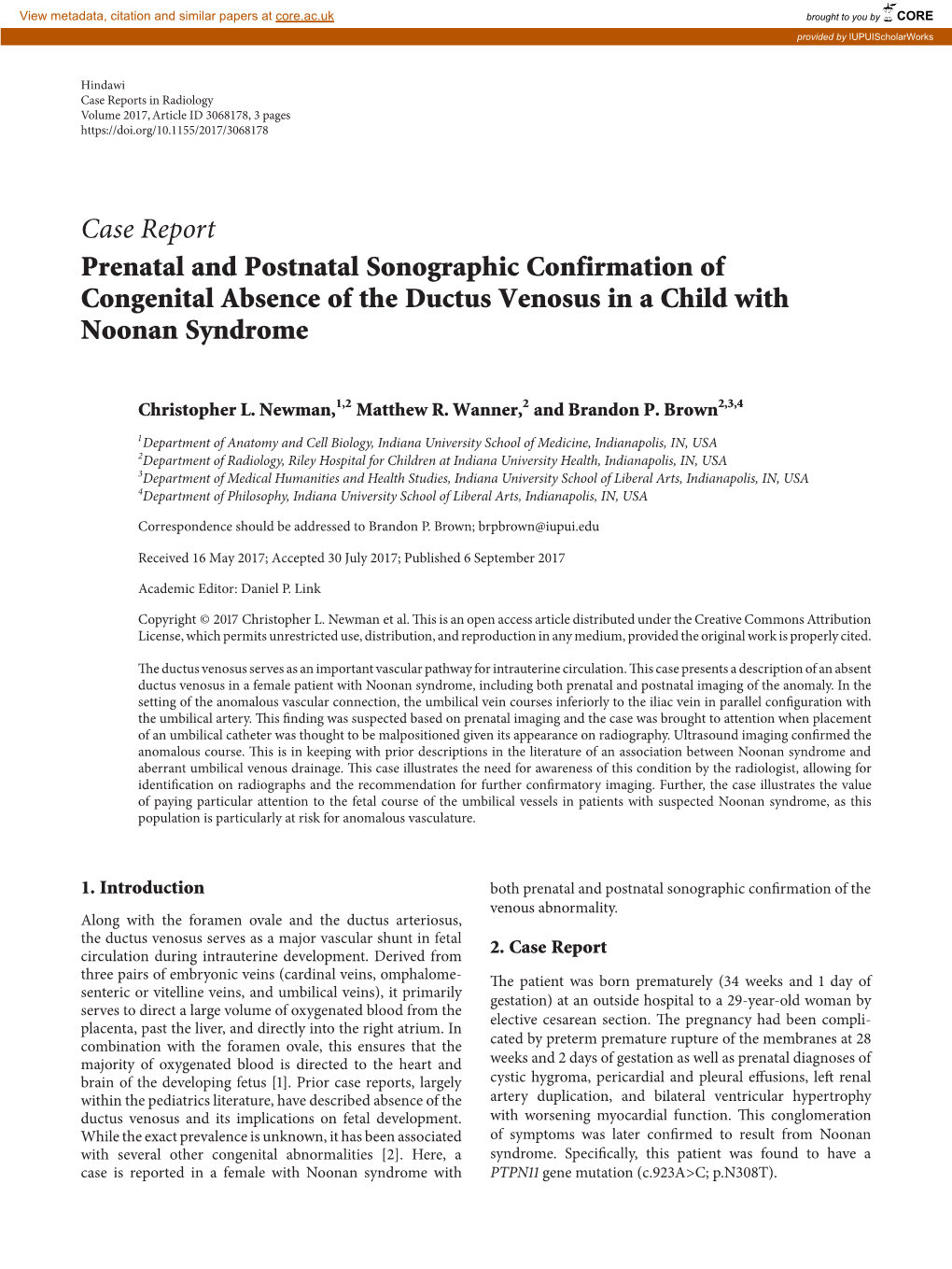 Case Report Prenatal and Postnatal Sonographic Confirmation of Congenital Absence of the Ductus Venosus in a Child with Noonan Syndrome