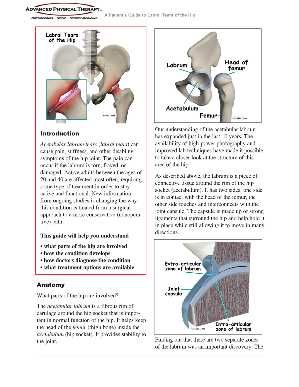 Labral Tears of the Hip