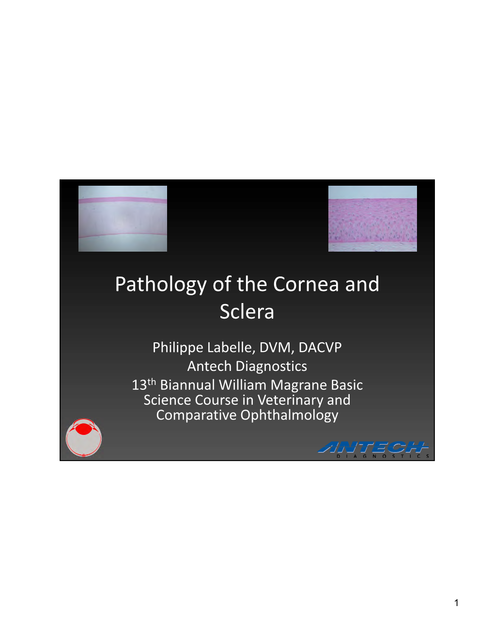 Pathology of the Cornea and Sclera