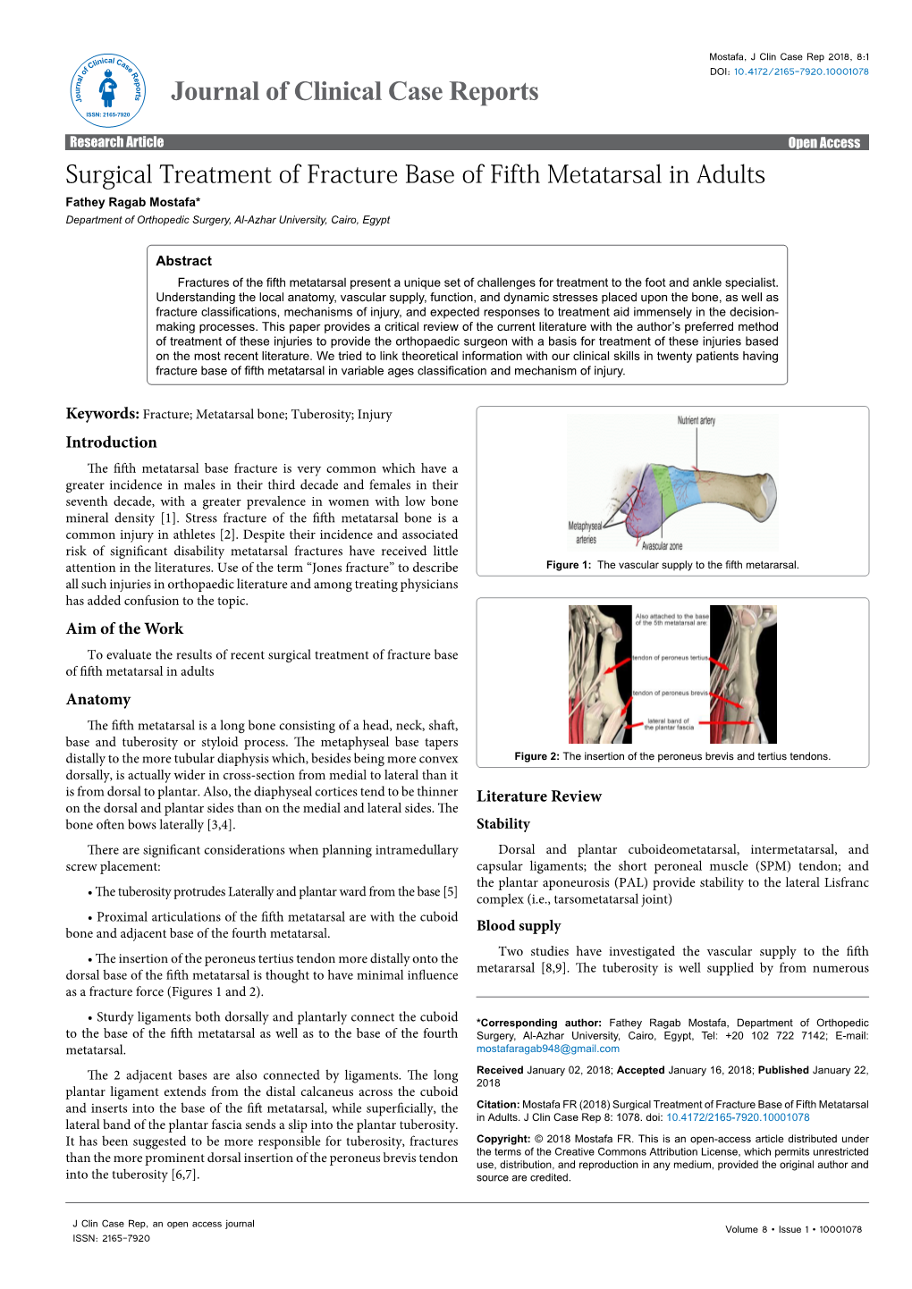 Surgical Treatment of Fracture Base of Fifth Metatarsal in Adults Fathey Ragab Mostafa* Department of Orthopedic Surgery, Al-Azhar University, Cairo, Egypt