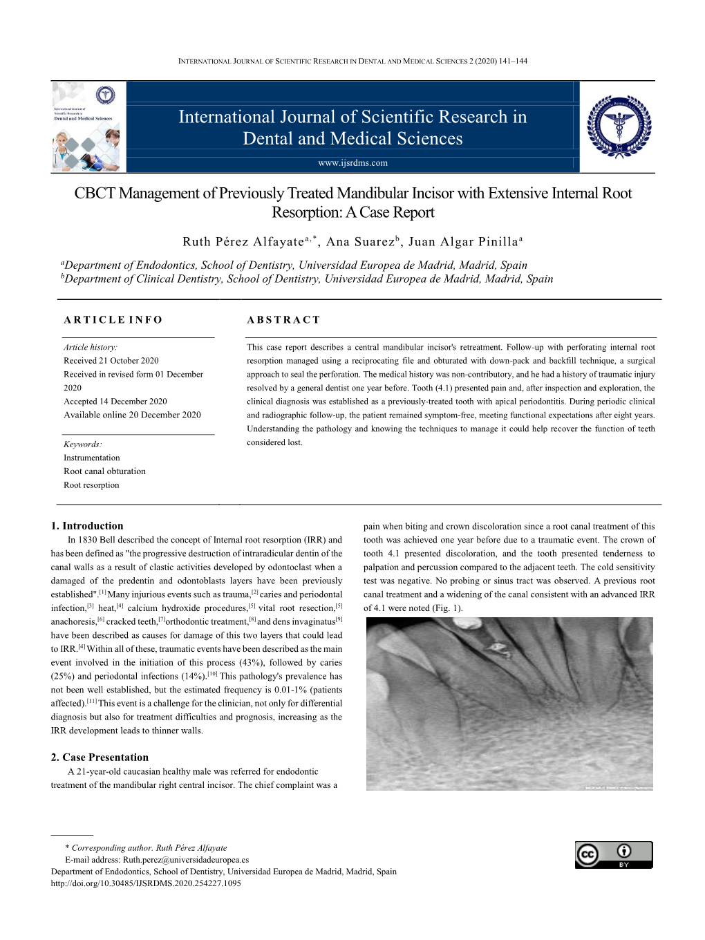 International Journal of Scientific Research in Dental and Medical Sciences 2 (2020) 141–144