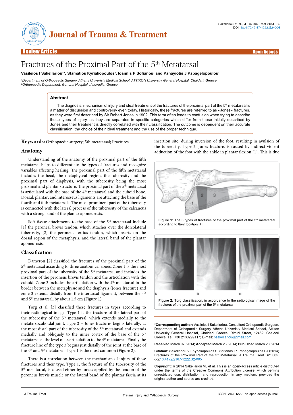 Fractures of the Proximal Part of the 5Th Metatarsal