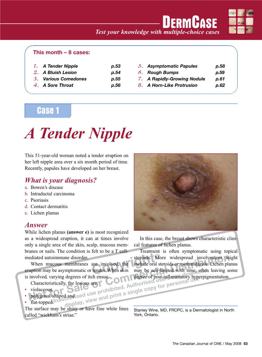 A Tender Nipple P.53 5