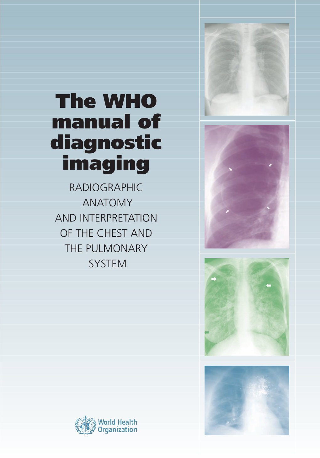 WHO Manual of Diagnostic Imaging: Radiographic Anatomy and Interpretation of the Chest