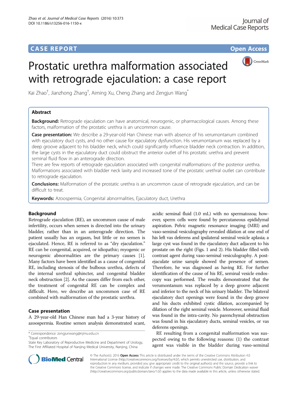 Prostatic Urethra Malformation Associated with Retrograde Ejaculation: a Case Report Kai Zhao†, Jianzhong Zhang†, Aiming Xu, Cheng Zhang and Zengjun Wang*