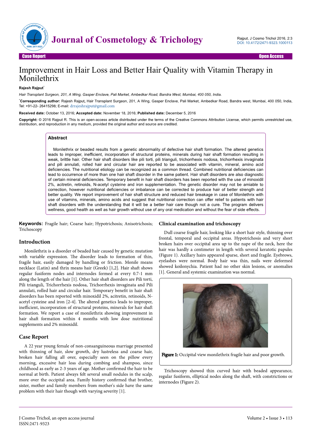 Improvement in Hair Loss and Better Hair Quality with Vitamin Therapy In