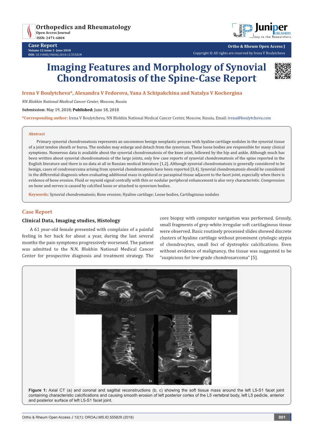 Imaging Features and Morphology of Synovial Chondromatosis of the Spine-Case Report