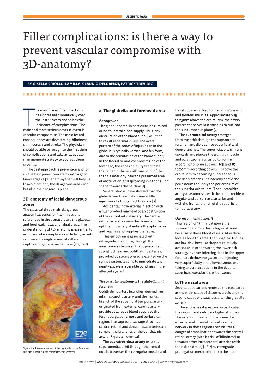 Filler Complications: Is There a Way to Prevent Vascular Compromise with 3D-Anatomy?
