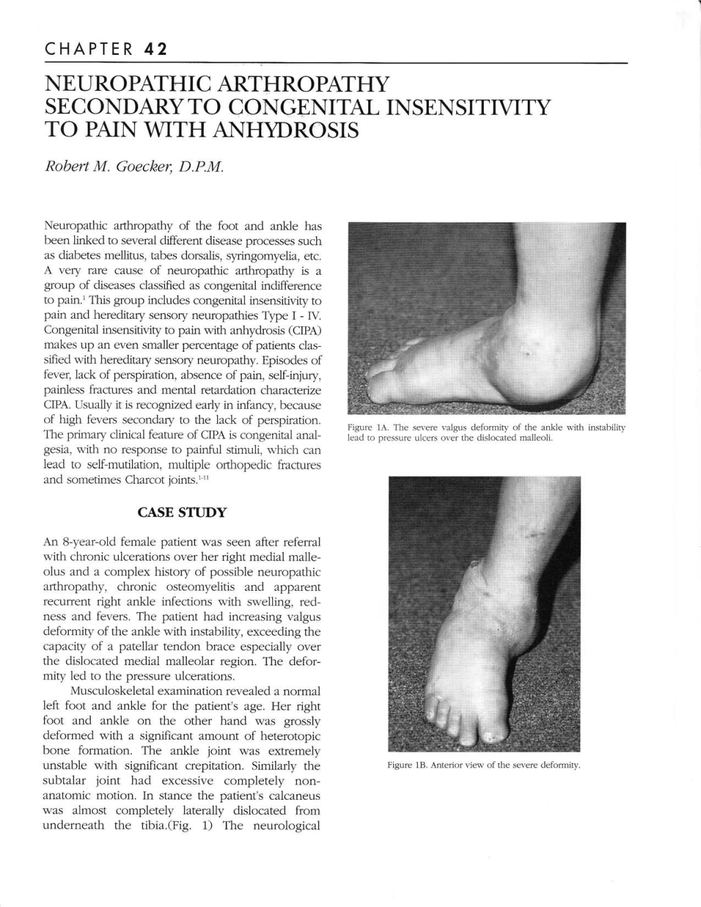 Chapter 42 Neuropathic Arthropathy Secondary to Congenital Insensittvity to Pain with Anh]'Drosis