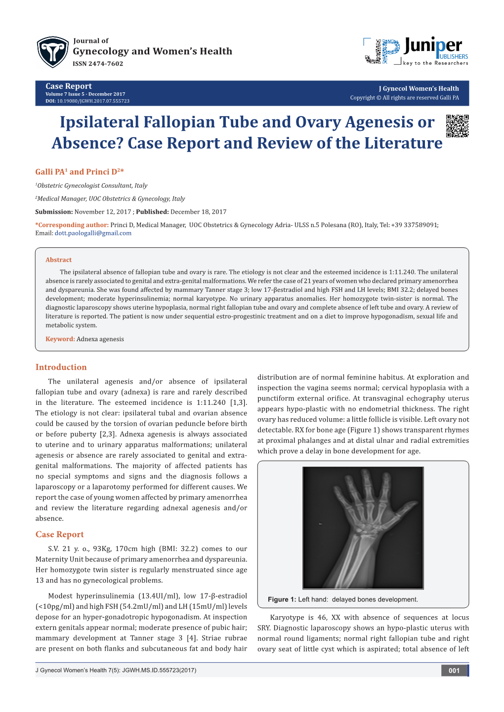 Ipsilateral Fallopian Tube and Ovary Agenesis Or Absence? Case Report and Review of the Literature