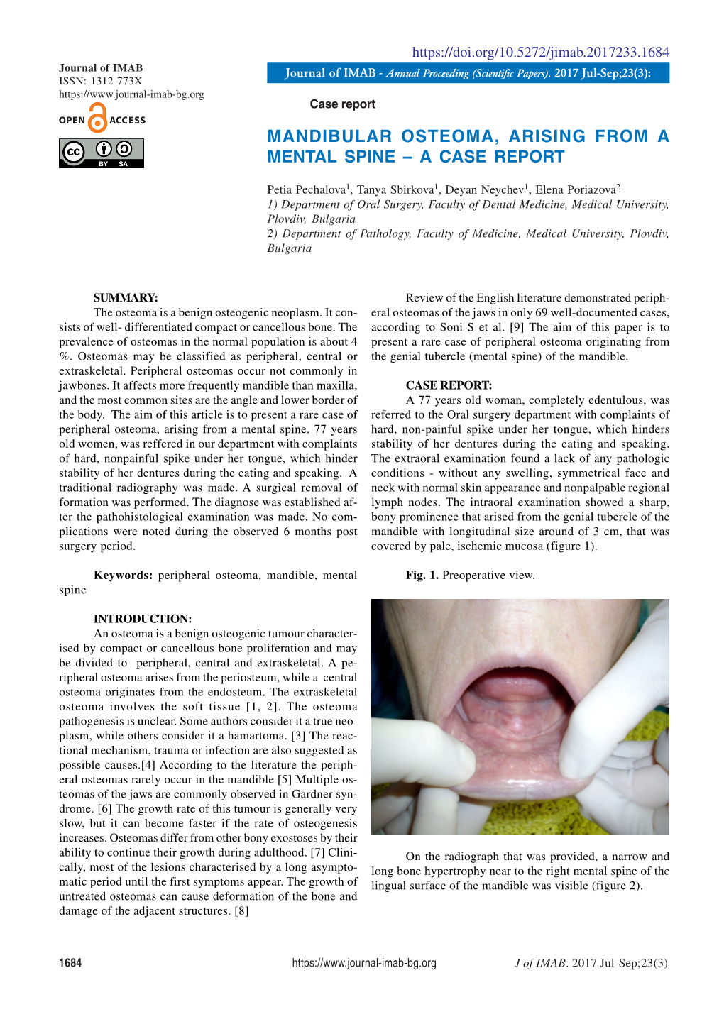 Mandibular Osteoma, Arising from a Mental Spine – a Case Report