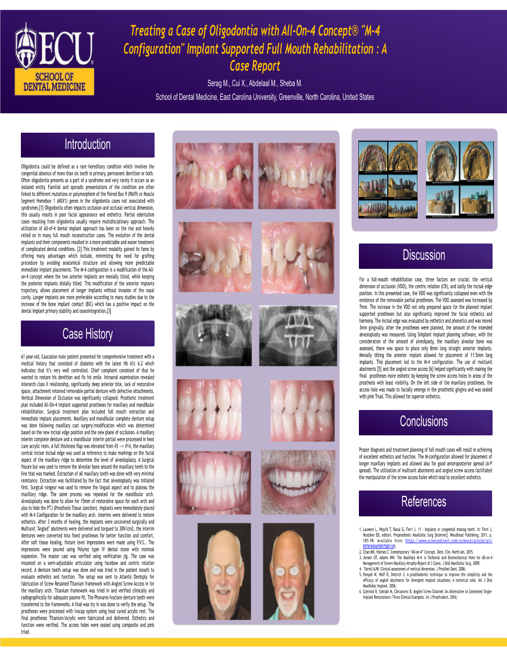 Implant Supported Full Mouth Rehabilitation : a Case Report Serag M., Cui X., Abdelaal M., Sheba M