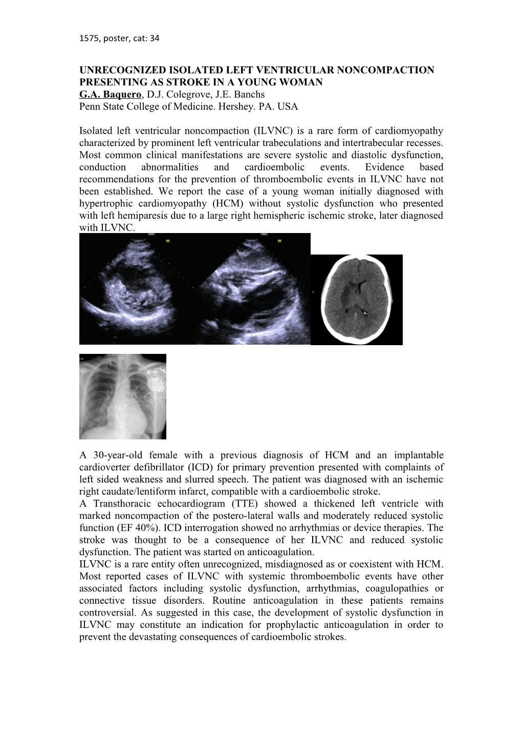 Unrecognized Isolated Left Ventricular Noncompaction Presenting As Stroke in a Young Woman