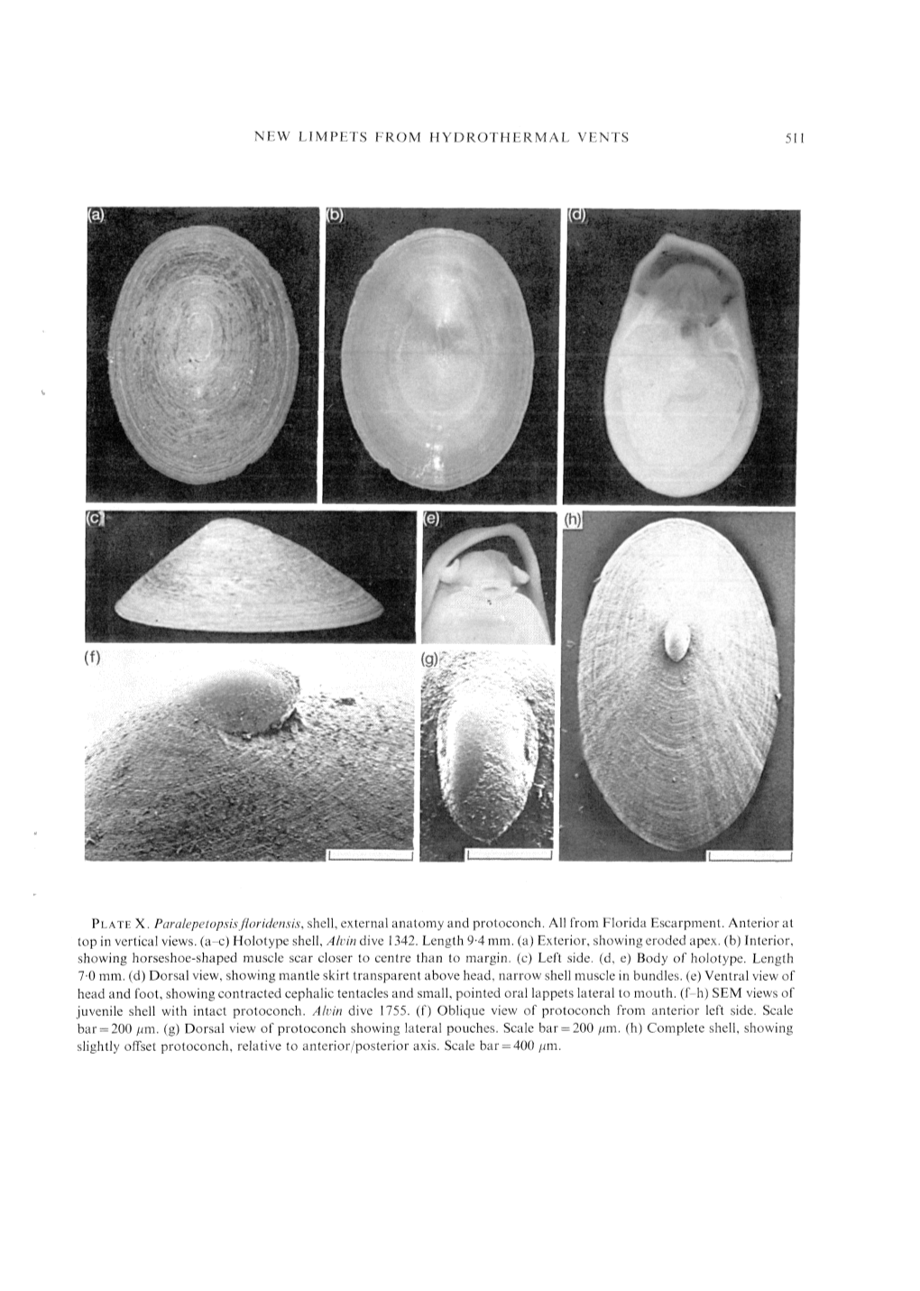 New Limpets from Hydrothermal Vents 511 Plate X